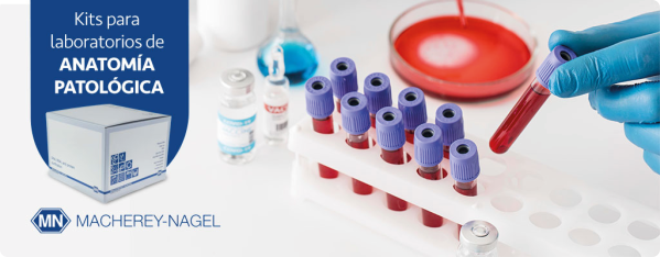 Macherey-Nagel: Extracción de ácidos nucleicos de biopsias líquidas y sólidas